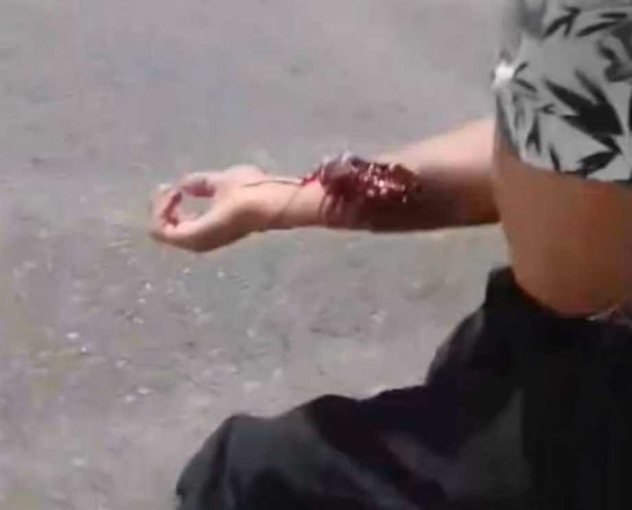 Puerto San Martín: un policía hirió con un tiro a un joven que venia de bailar